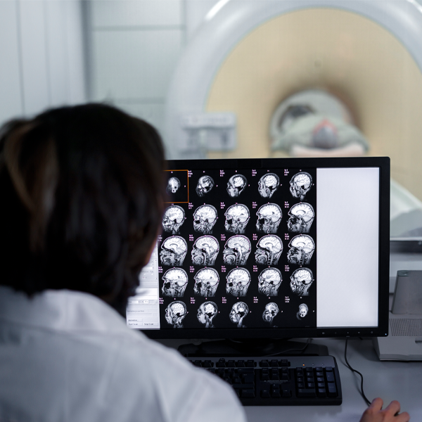 Investigație imagistică prin rezonanță magnetică la cap (RMN cranio-cerebral)